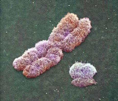 Cromosomas X y Y vistos con microscopio de barrido.