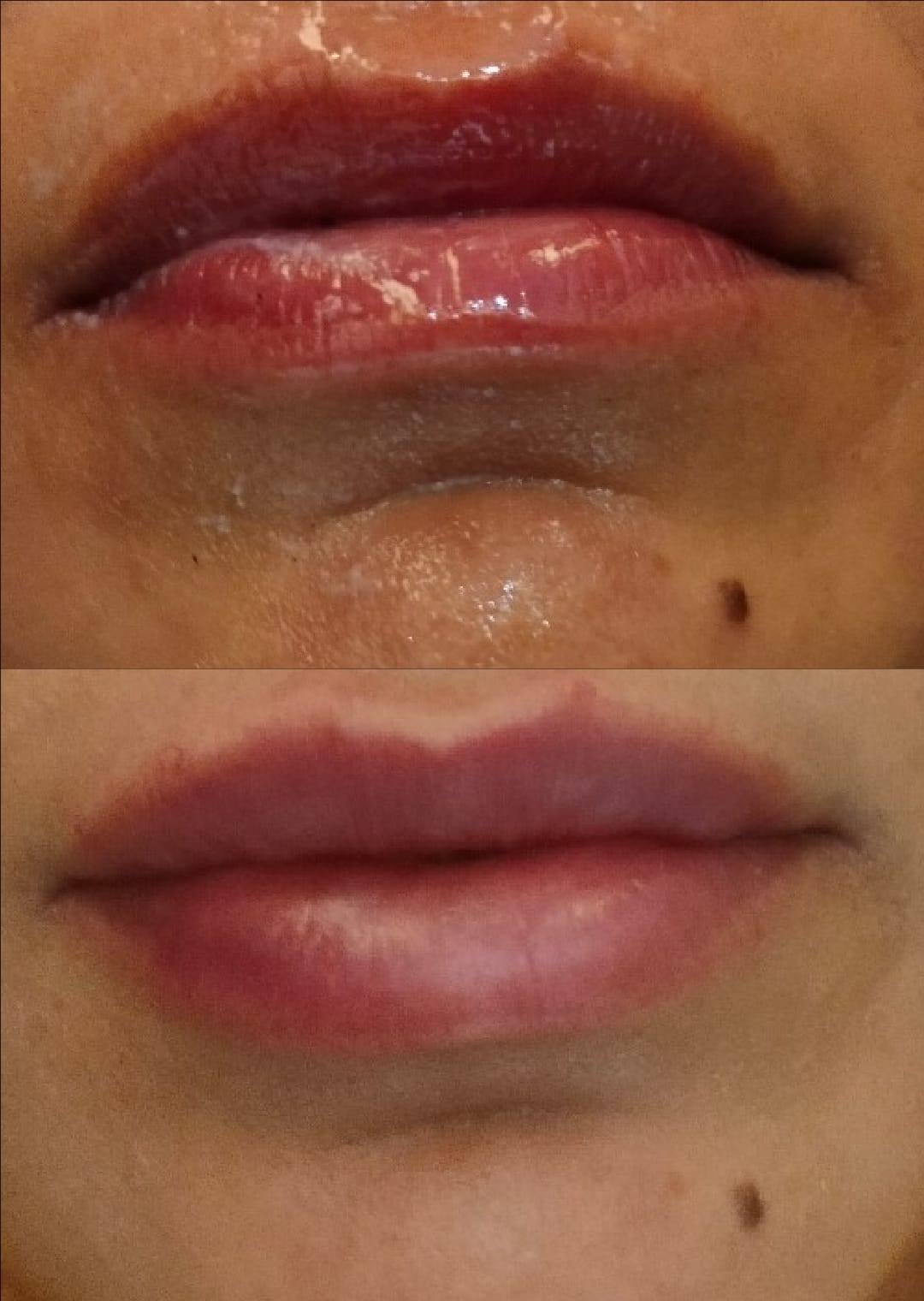 Hidratación de labios