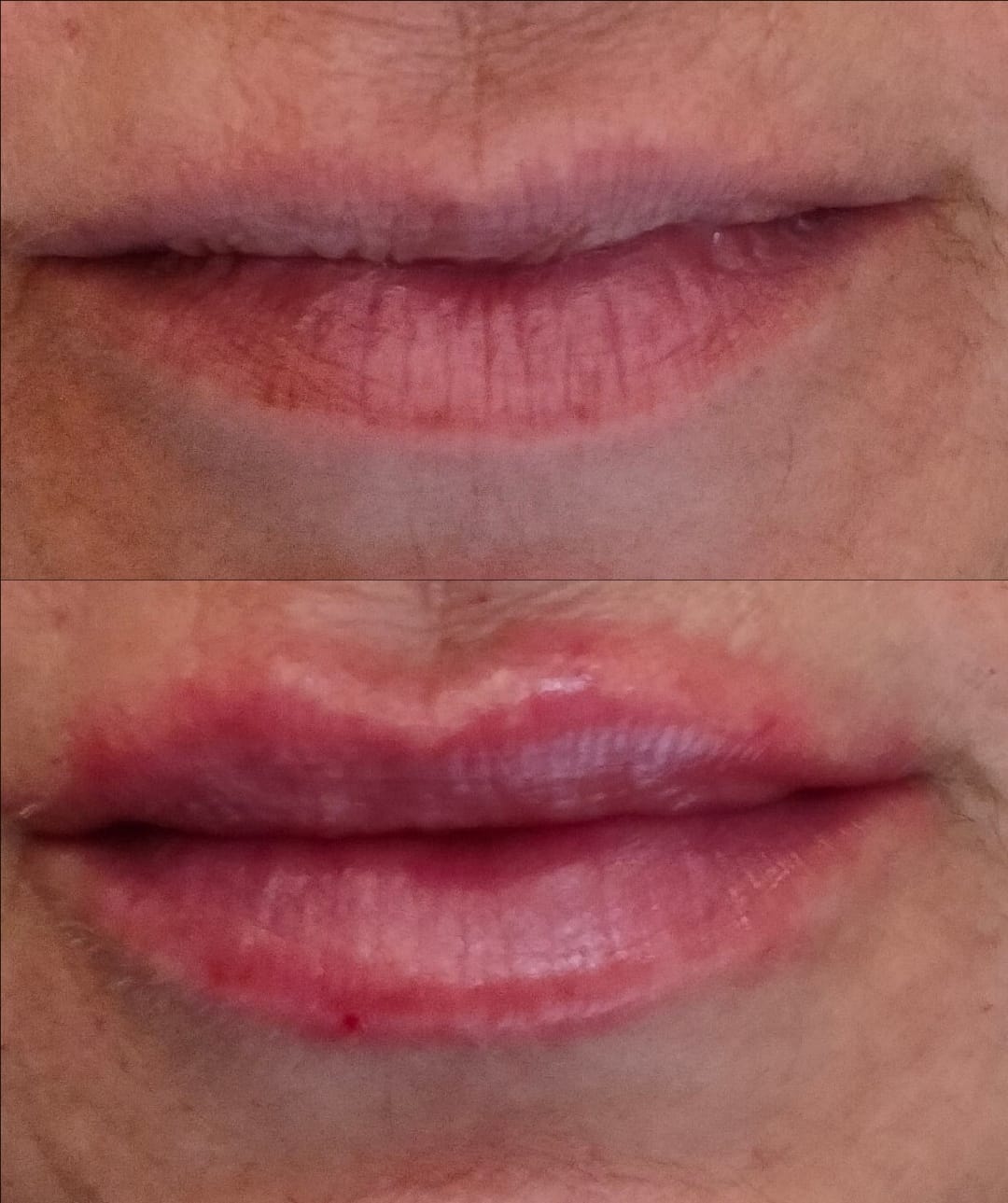 Hidratación de labios