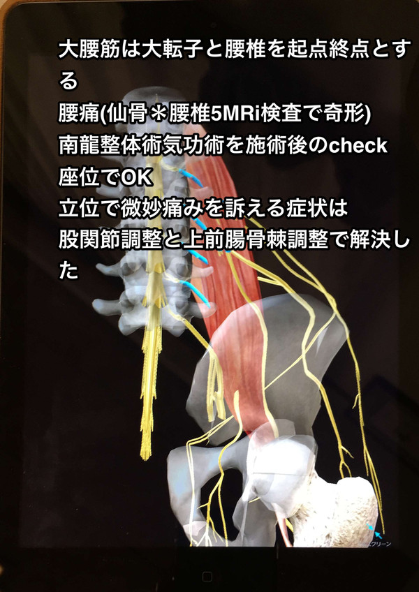 仙骨と腰椎5番の奥深いとこの痛み バッチりです痛み完全に無くなってます 慢性腰痛は長岡京市友岡の気功整体へ