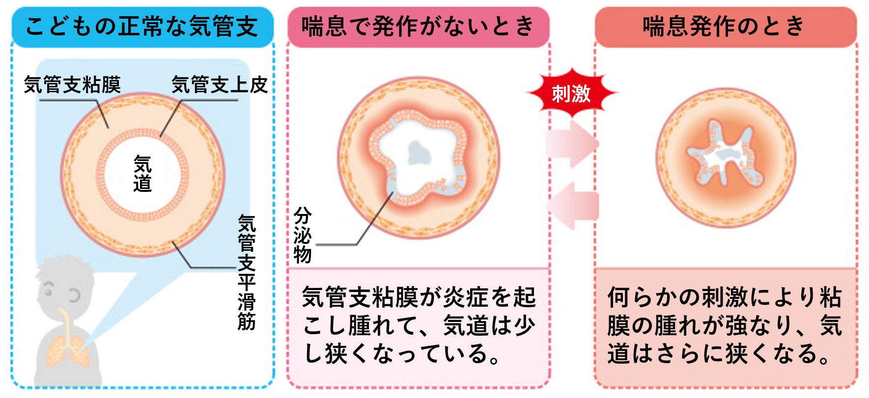 喘息 茨木市の小児科 はら小児科クリニック