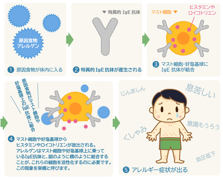 食物アレルギー 茨木市の小児科 はら小児科クリニック