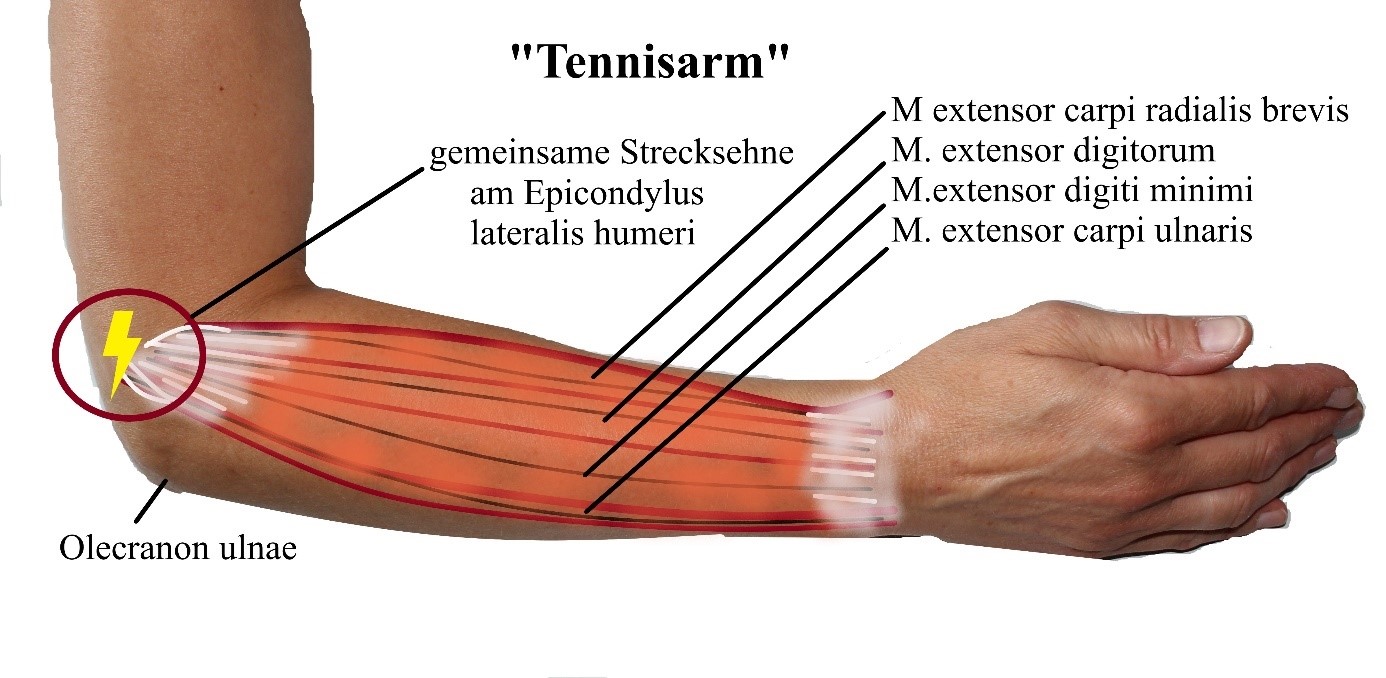 Region 1 Muskulatur Sehnen Weichteile See Feel Treats Webseite