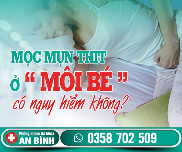 Mọc mụn thịt ở môi bé bị làm sao? Xử lý thế nào?