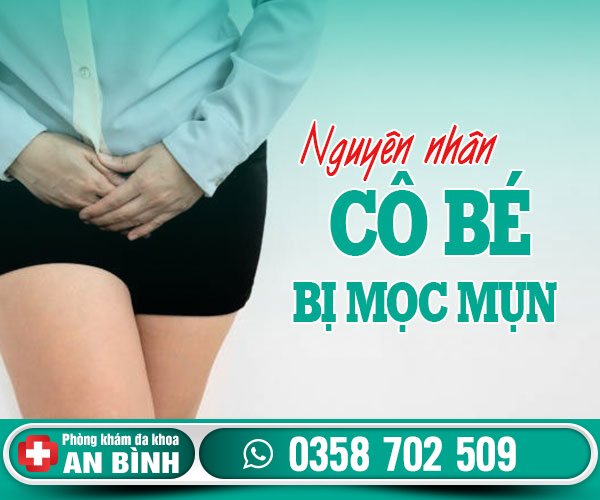 Nguyên nhân cô bé bị mọc mụn