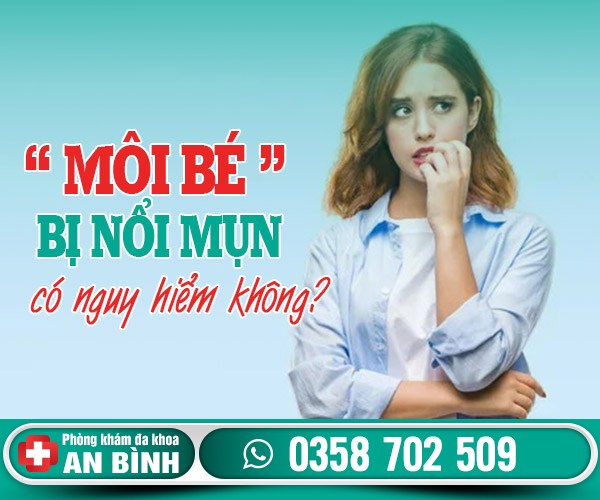 Môi bé bị nổi mụn – Dấu hiệu bất thường không nên chủ quan