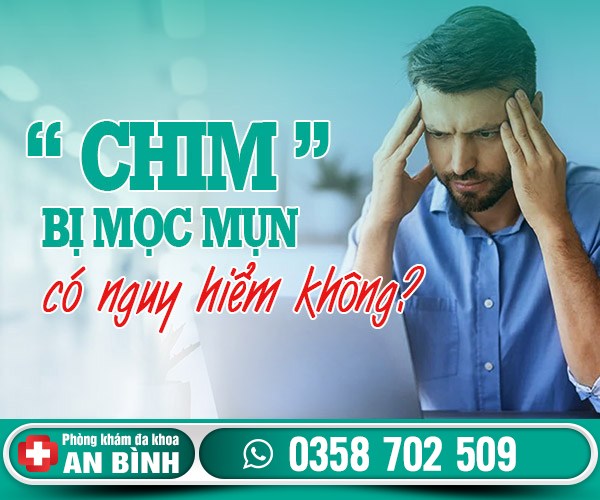 Chim bị mọc mụn: Nguyên nhân, dấu hiệu và cách điều trị hiệu quả