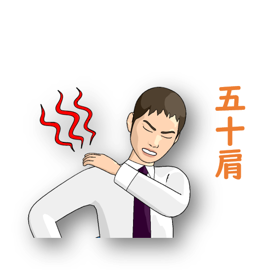 五十肩の図