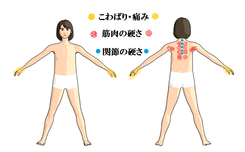 背中のコリと手のこわばり 葛飾区新小岩 おぐち針灸院で初めてでも