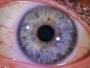 Lymphatique fibrillaire