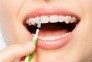 181602736 - Female mouth with braces and interdental brush © Sergey Novikov 