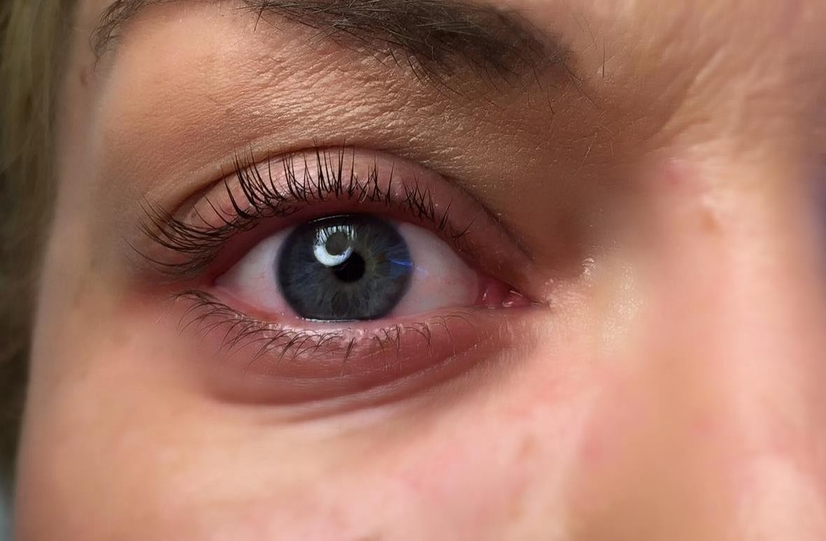Wimpernkranzverdichtung oben Permanentyoung Nicole Scherz