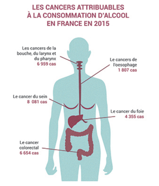 Alcool Les complications de l