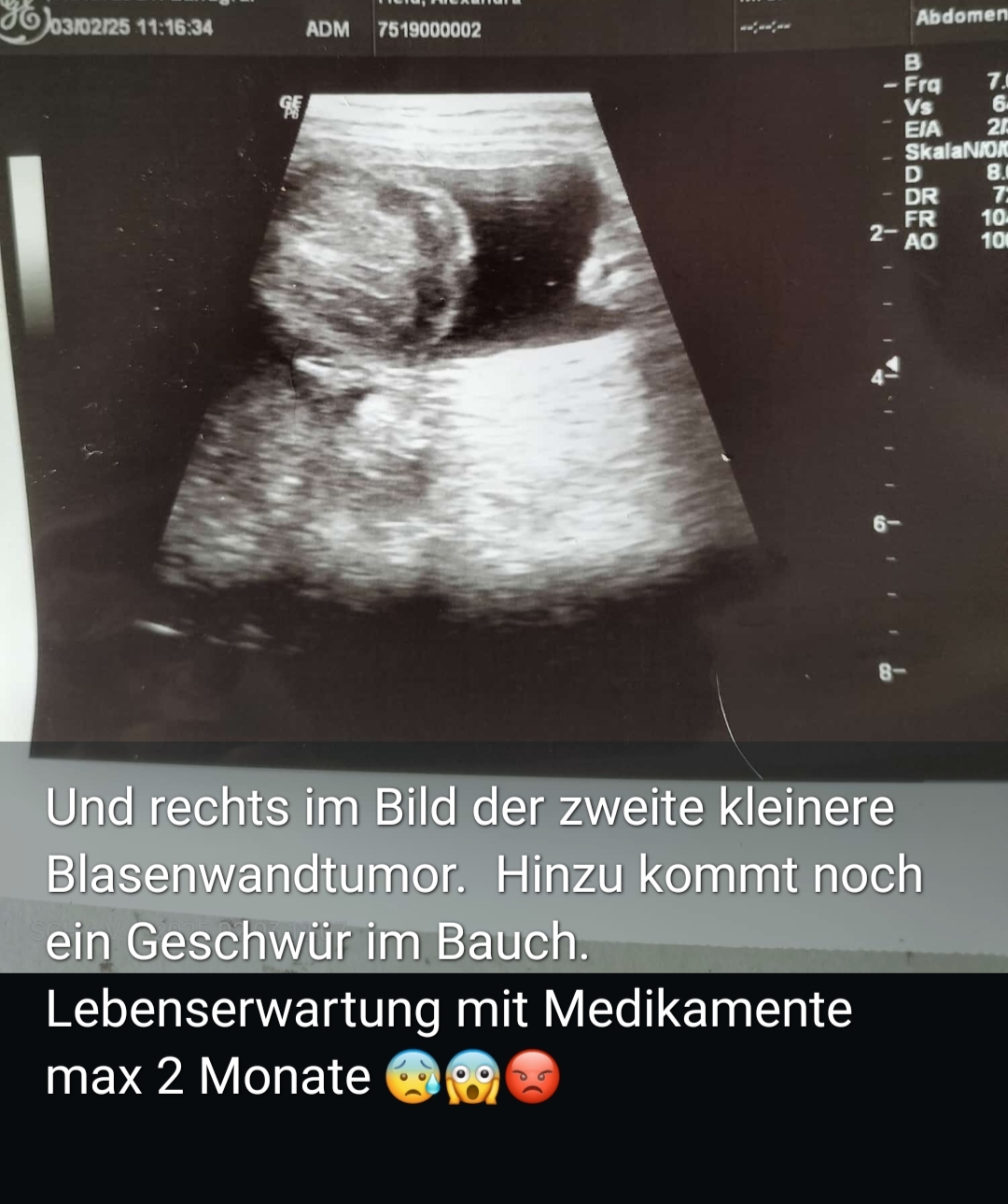 03.02.25 Baxter seine Diagnose steht nun fest