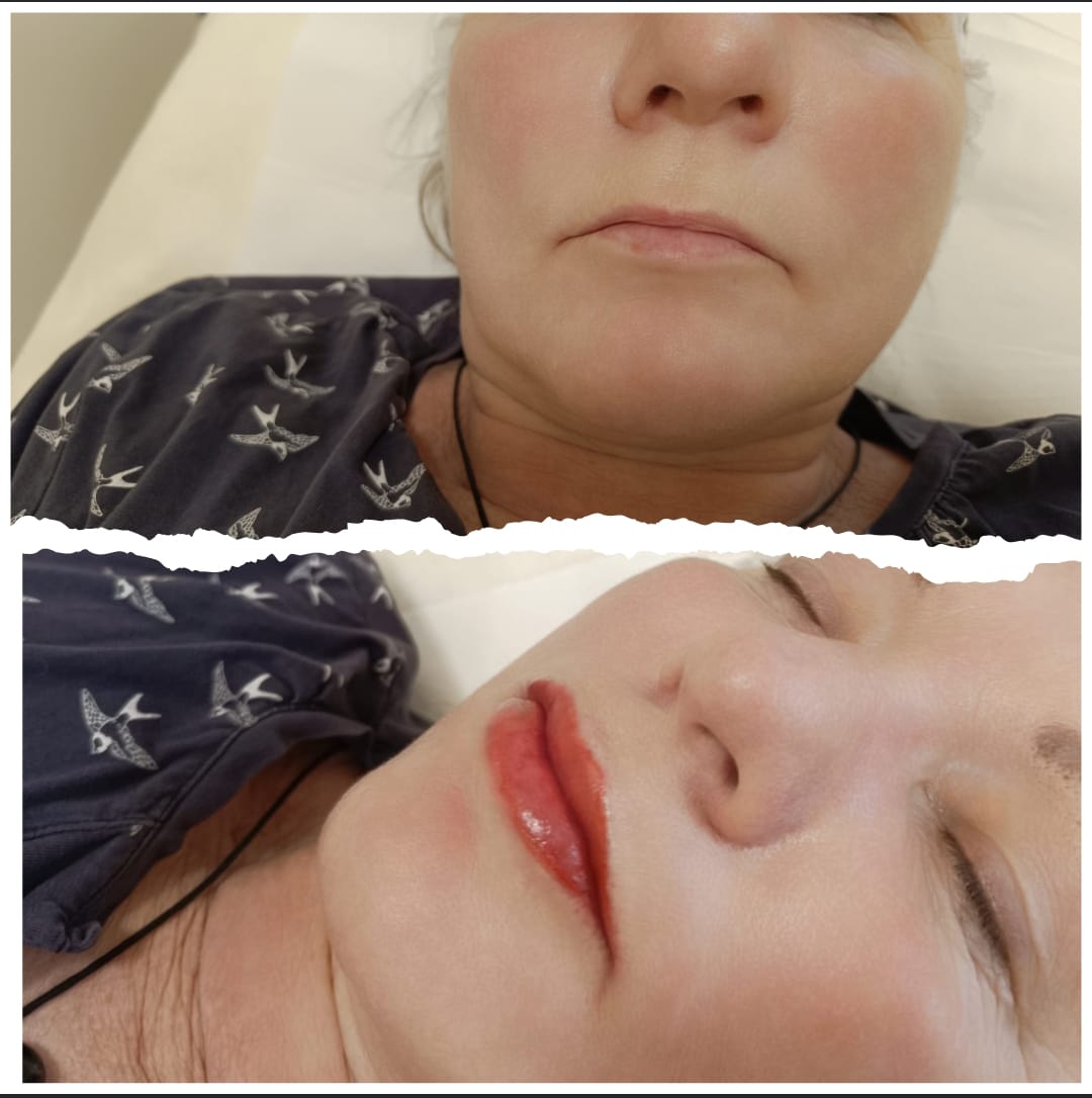 Lippen - klare Definition