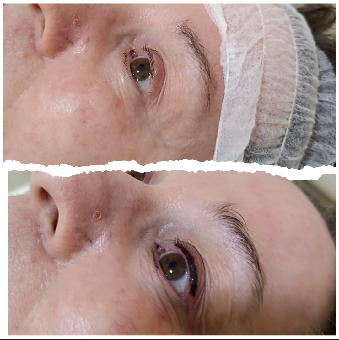 Betonung der Augen