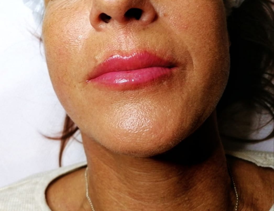 softe Lippenpigmentierung