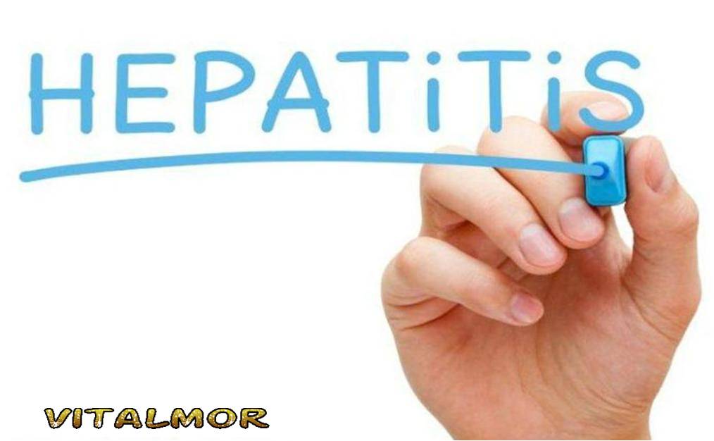 Hepatitis, Cirrosis...
