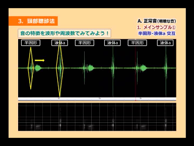 正常音（明瞭な音）の音響分析を示した図