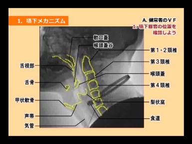 嚥下造影検査（VF)の写真を使った嚥下器官の解剖図