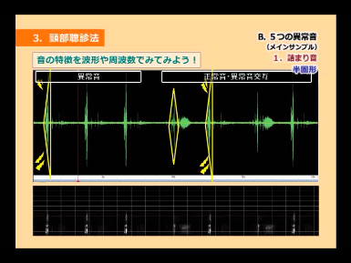 異常音・詰まり音の音響分析を示した図