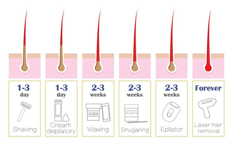 electrolisys hair removal methods permanent