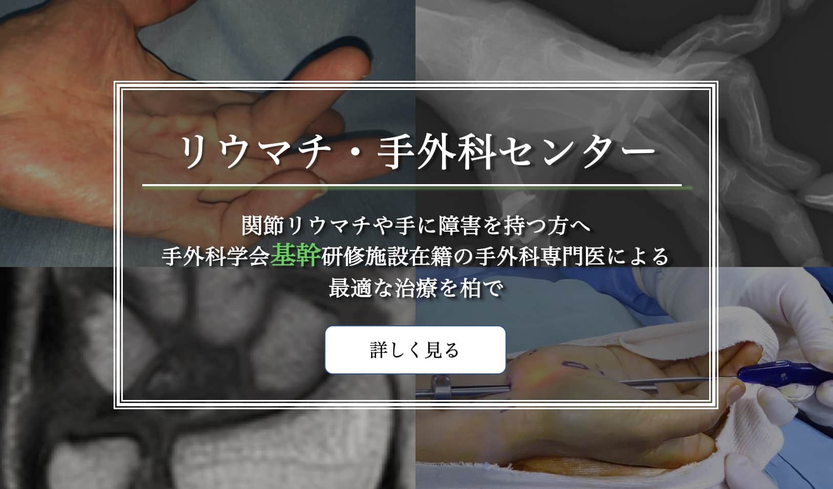 人工指・手関節・肘関節置換術、鏡視下手術（手関節TFCC、母指CM関節形成術）、鏡視下手根管開放術など