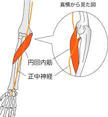 円回内筋症候群について