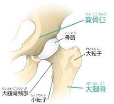 変形性股関節症