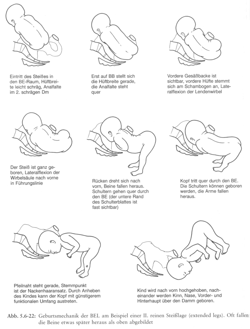 Vaginale Geburt aus Beckenendlage schwangerschaftsfahrplan.de