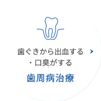 歯周病治療