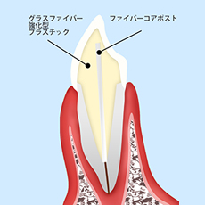 ファイバーコア