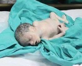 Nabila Eid Rafat al-Louh's unborn child, aug 20