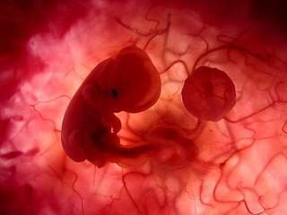 Bushra Sultan's Unborn baby, sept 19 2006
