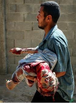 Anwar Ismael Abdul-Ghani Atallah 11, july 7 2006 Army shoots child in mouth in Gaza
