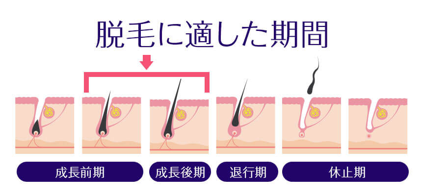 医療脱毛はじめました