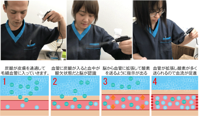 松山市頭痛専門整体 - 松山市あさひ整体院