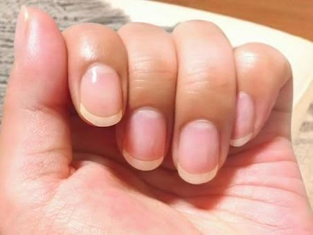 爪がのびていないかチェックしていますか？
