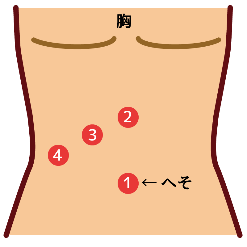 胆嚢摘出手術レポート手術入院編【体験談】