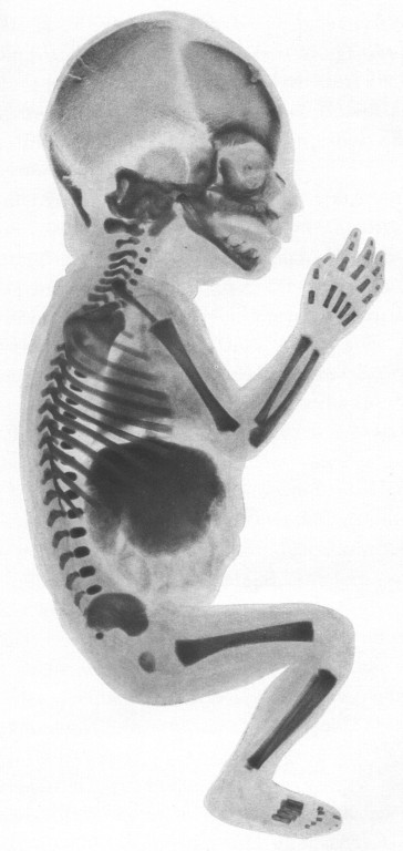 Spalteholzpräparat eses Embryos