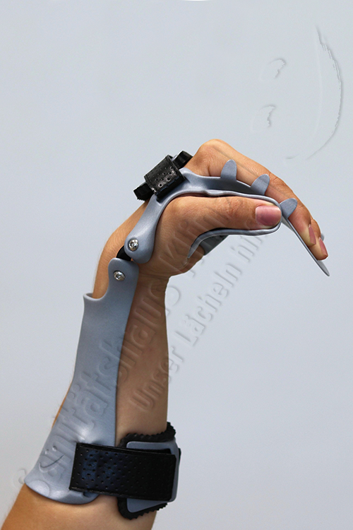 Armorthese Handorthese Lagerungsorthese dynamisch Orthese 3D-Druck atmungsaktiv WHO HO Schlaganfall Apoplex Parese Sanitätshaus Klinz Bernburg