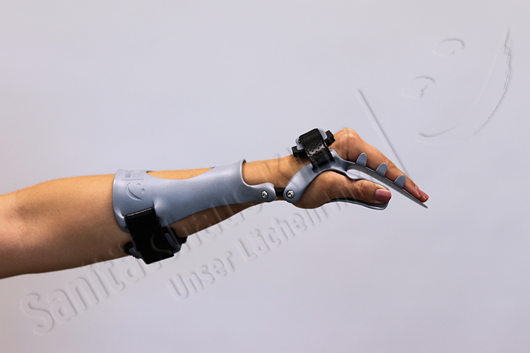 Armorthese Handorthese Lagerungsorthese dynamisch Orthese 3D-Druck atmungsaktiv WHO HO Schlaganfall Apoplex Parese Sanitätshaus Klinz Bernburg