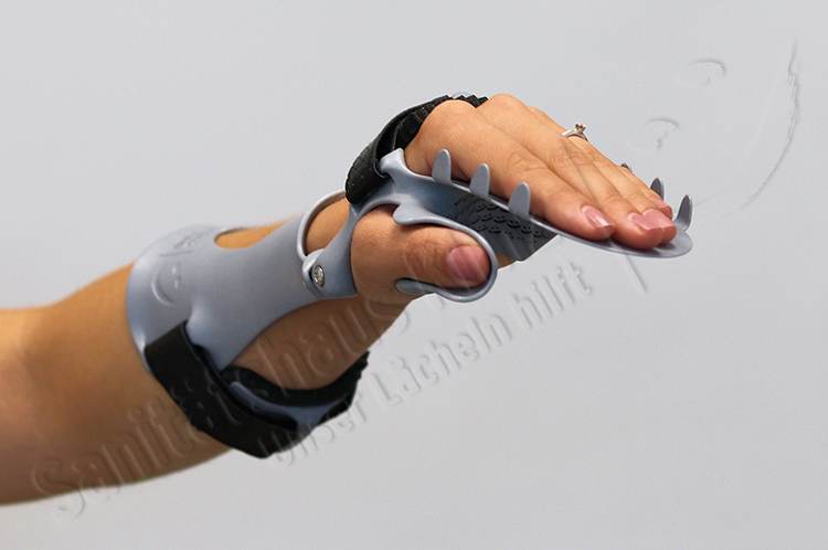 Armorthese Handorthese Lagerungsorthese dynamisch Orthese 3D-Druck atmungsaktiv WHO HO Schlaganfall Apoplex Parese Sanitätshaus Klinz Bernburg