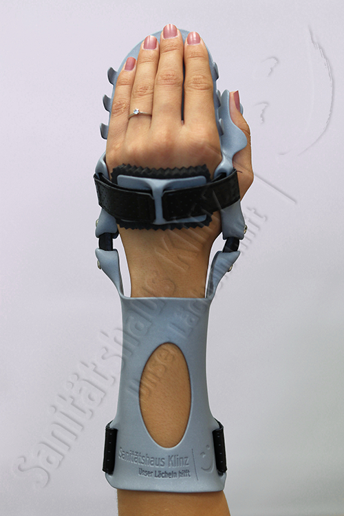 Armorthese Handorthese Lagerungsorthese dynamisch Orthese 3D-Druck atmungsaktiv WHO HO Schlaganfall Apoplex Parese Sanitätshaus Klinz Bernburg