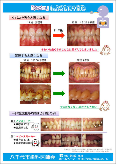 あいはら歯科医院　禁煙の勧め