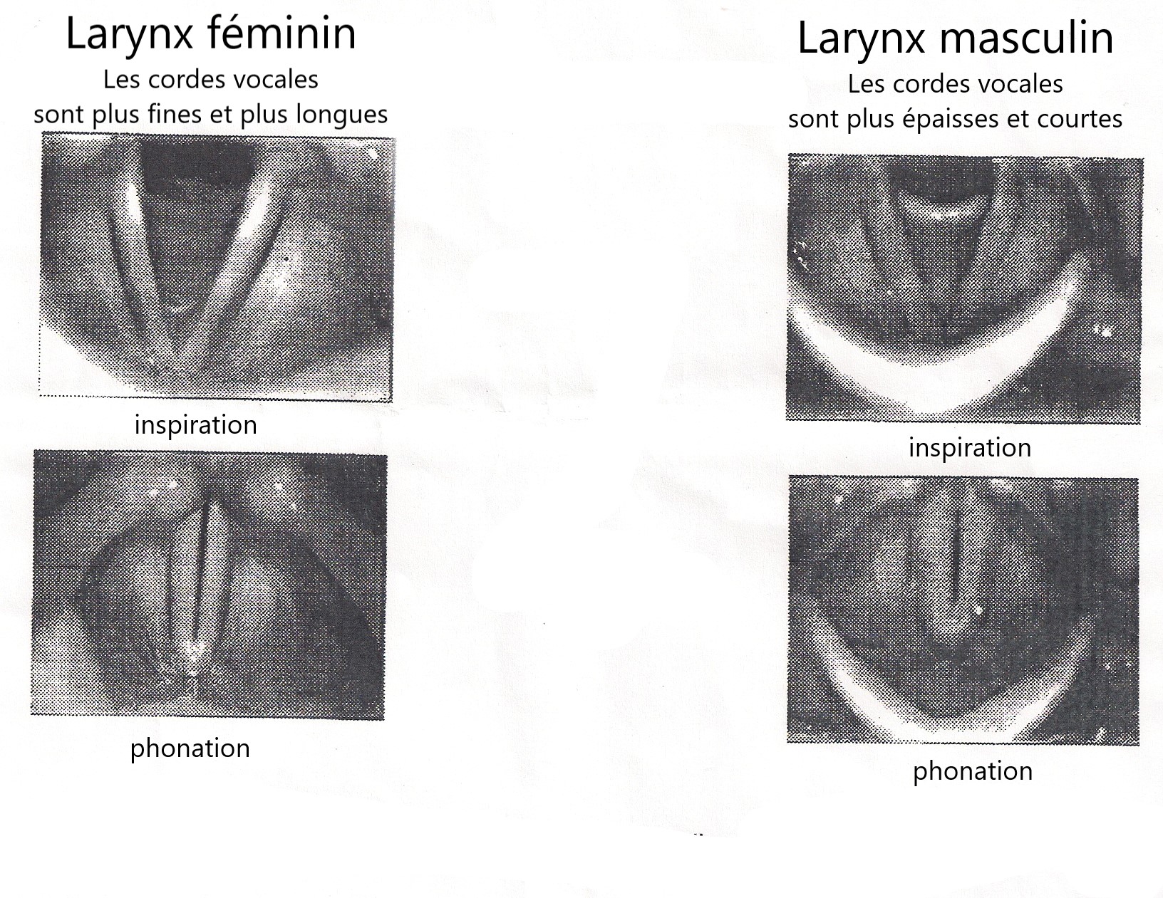 appareil respiratoire et cordes vocales A.C
