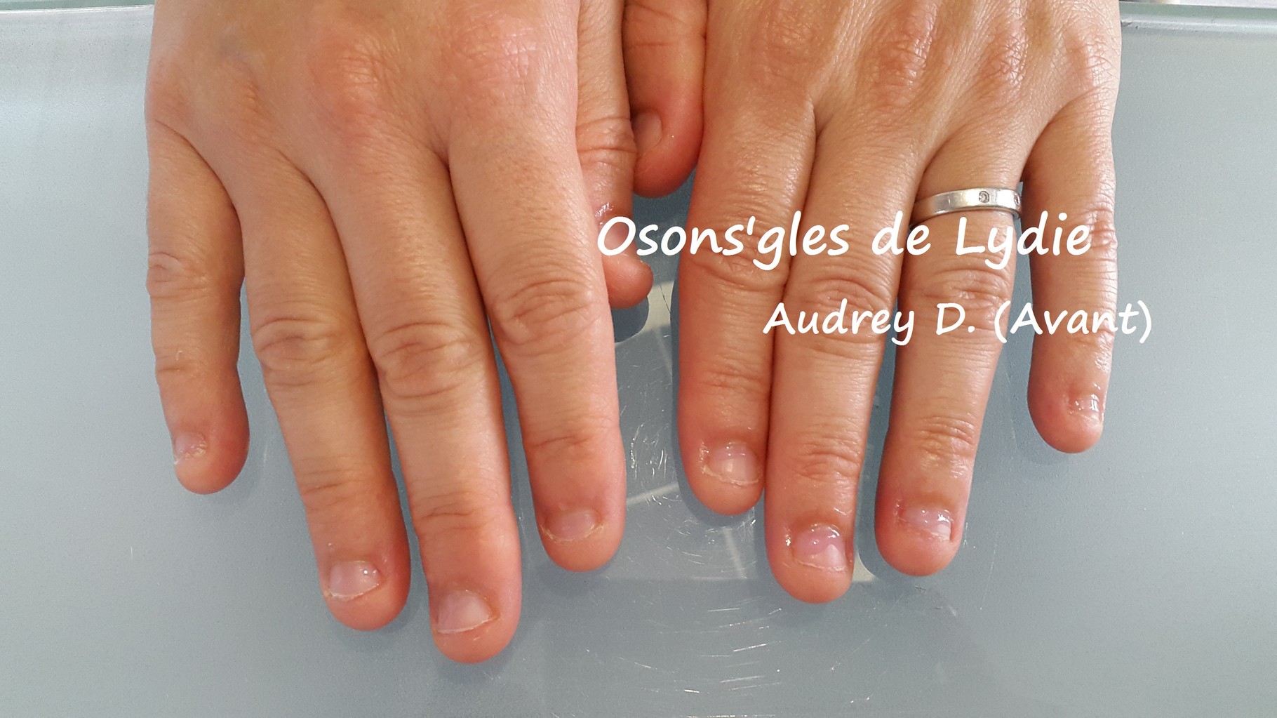 LES ONGLES RONGÉS Osons 'gles de Lydie — free download