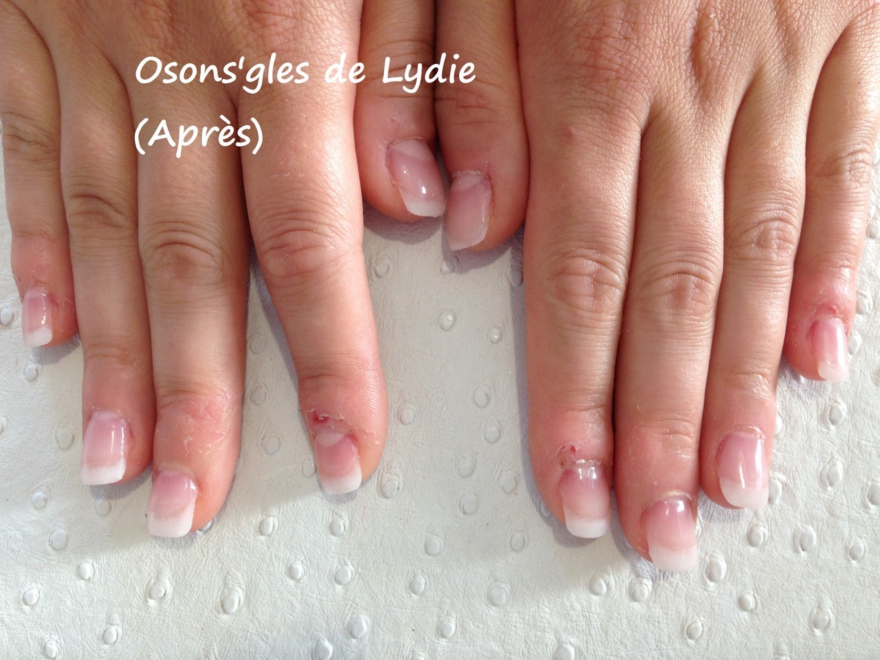 LES ONGLES RONGÉS Osons 'gles de Lydie — free download