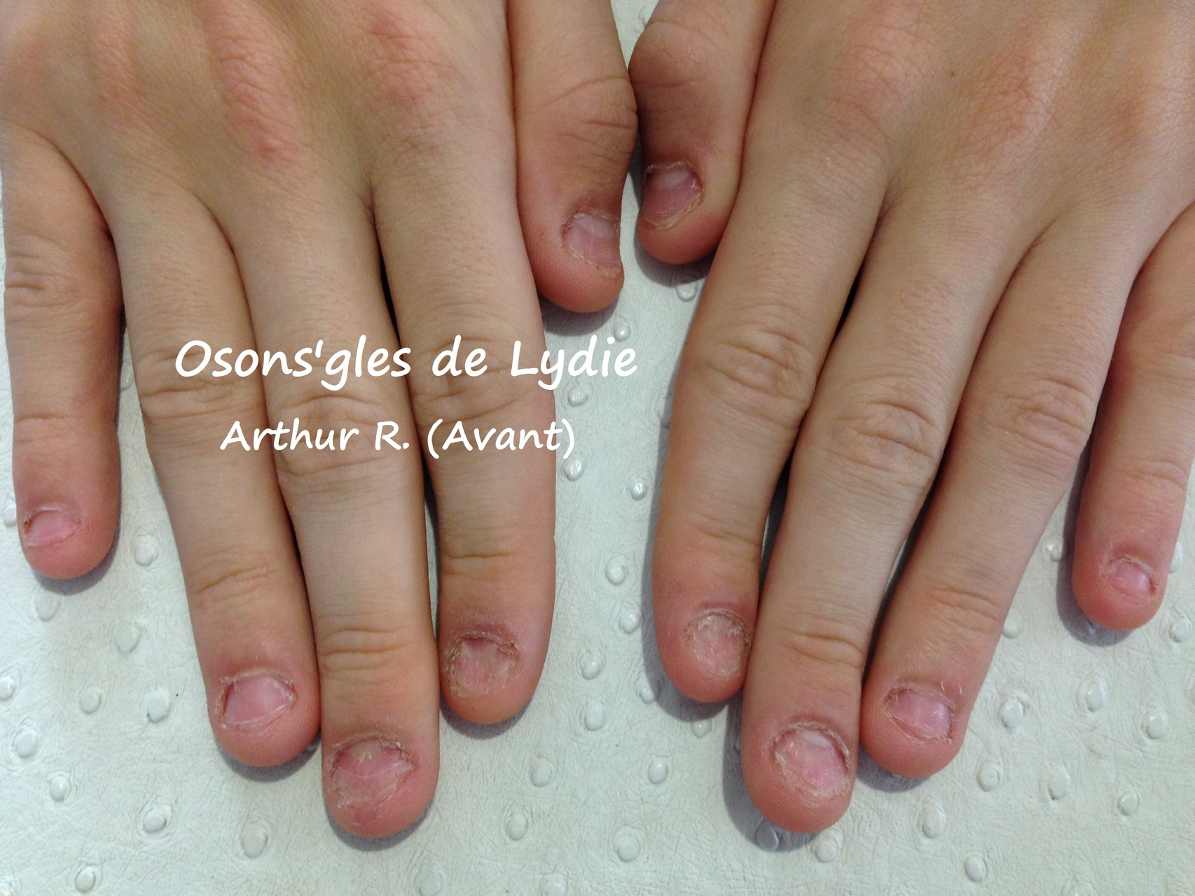 LES ONGLES RONGÉS Osons 'gles de Lydie — free download