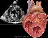 Herz im Ultraschallbild